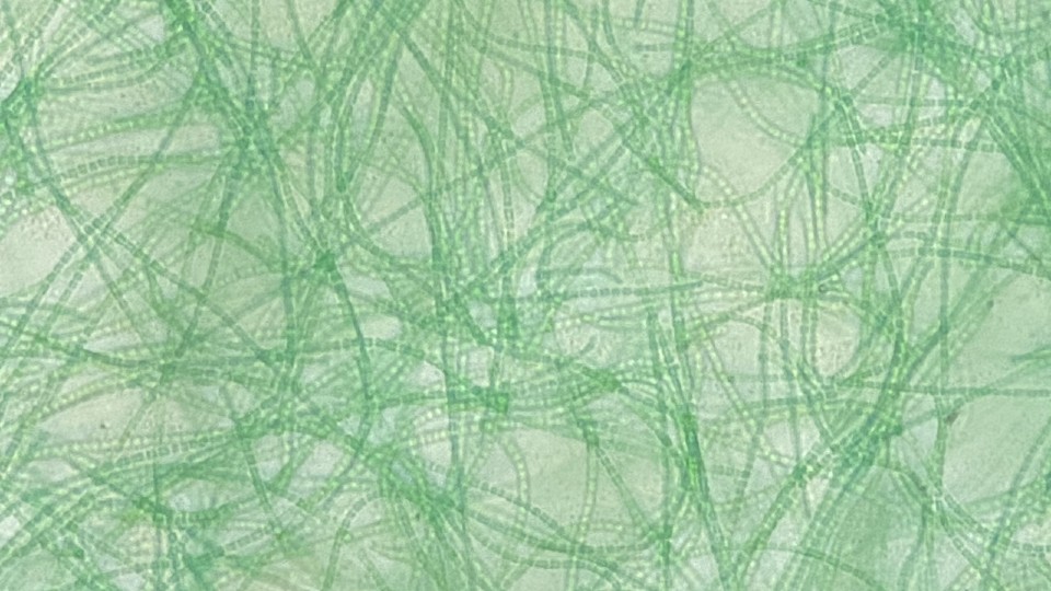 Cyanobacteria filaments under a microscope. Image courtesy of Nottingham Trent University.