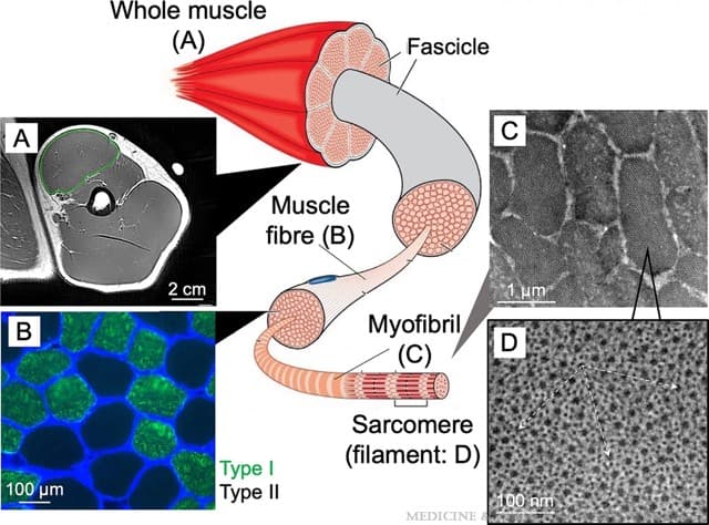 Diagram showing the different sections during a muscle bopsy